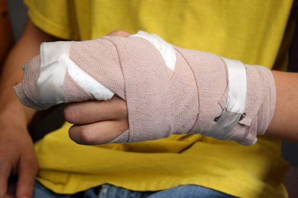 Broken finger symptoms
