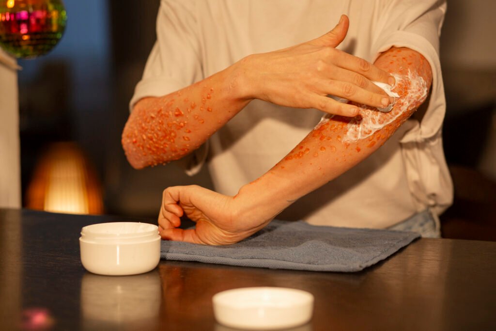 Skin Allergy Symptoms