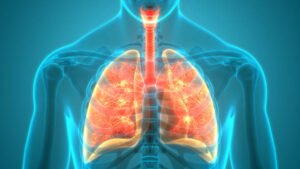 bronchitis symptoms