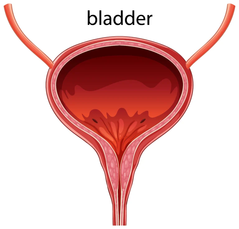 Bladder Infection vs UTI Key Differences Guide