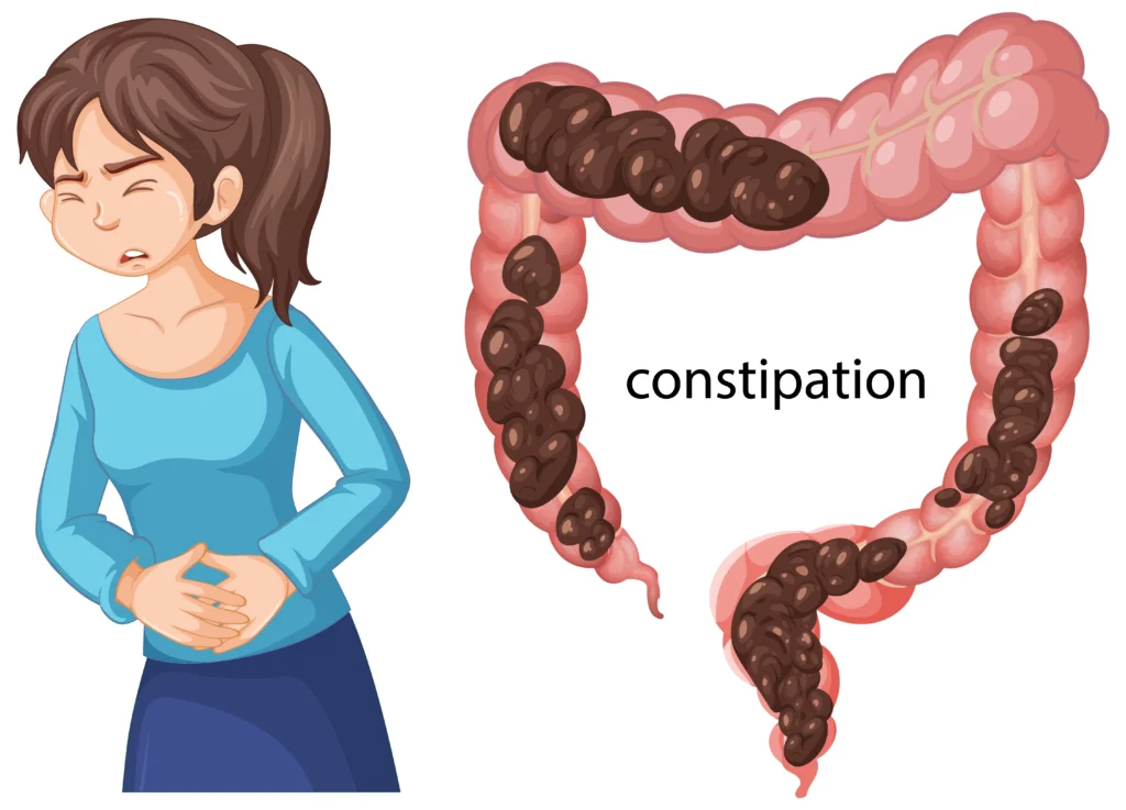 Constipation Symptoms Causes & Treatment Guide