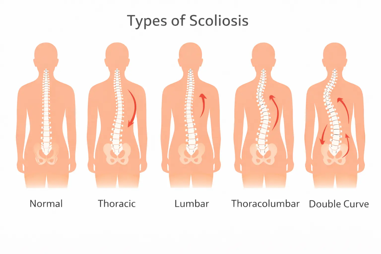 Back Pain: Symptoms, Causes & Treatment Guide