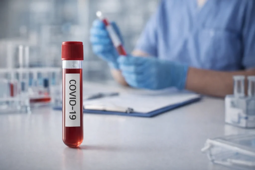 COVID-19 Symptoms, Causes, Tests and Treatment Guide