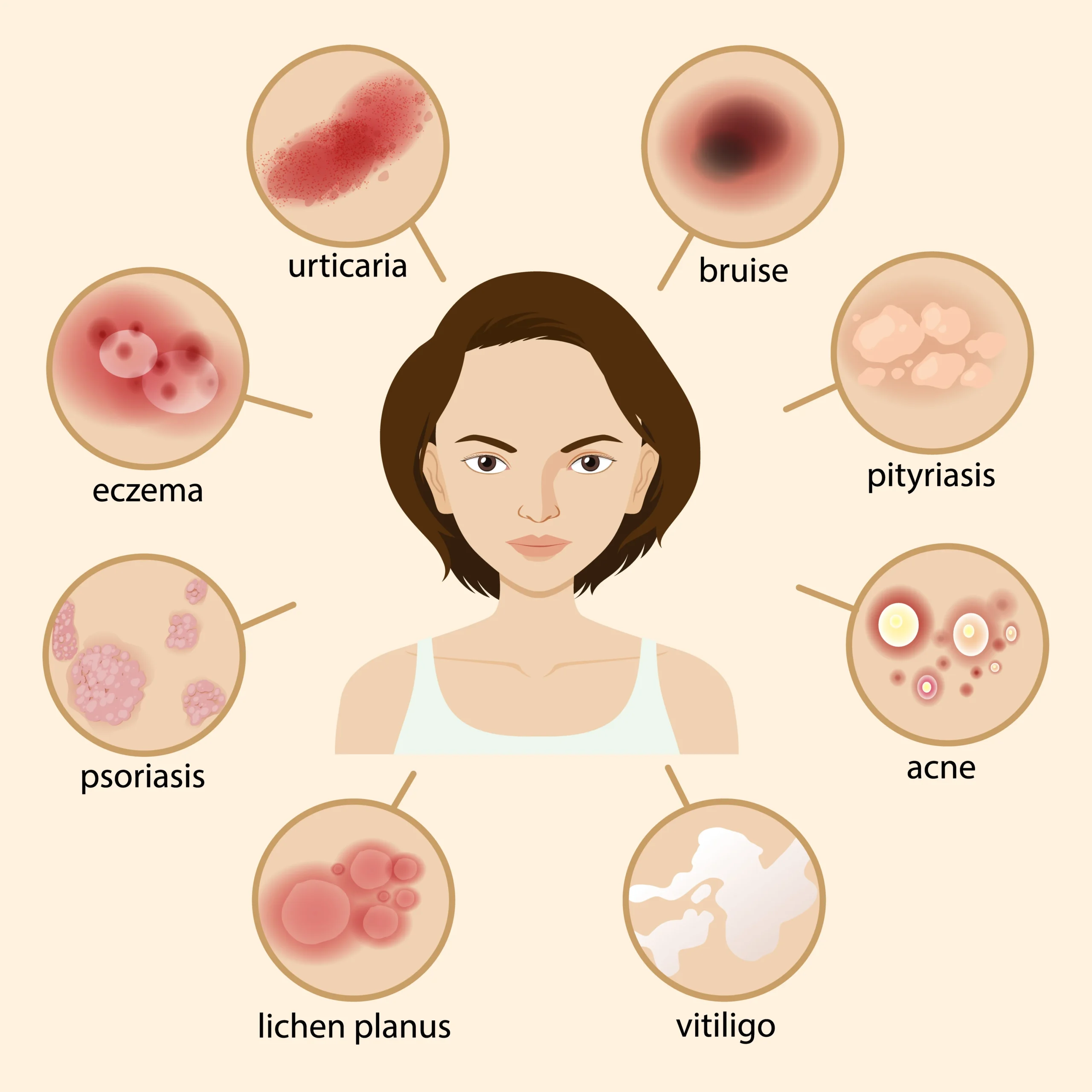 Dermatitis Symptoms Causes & Treatment Guide