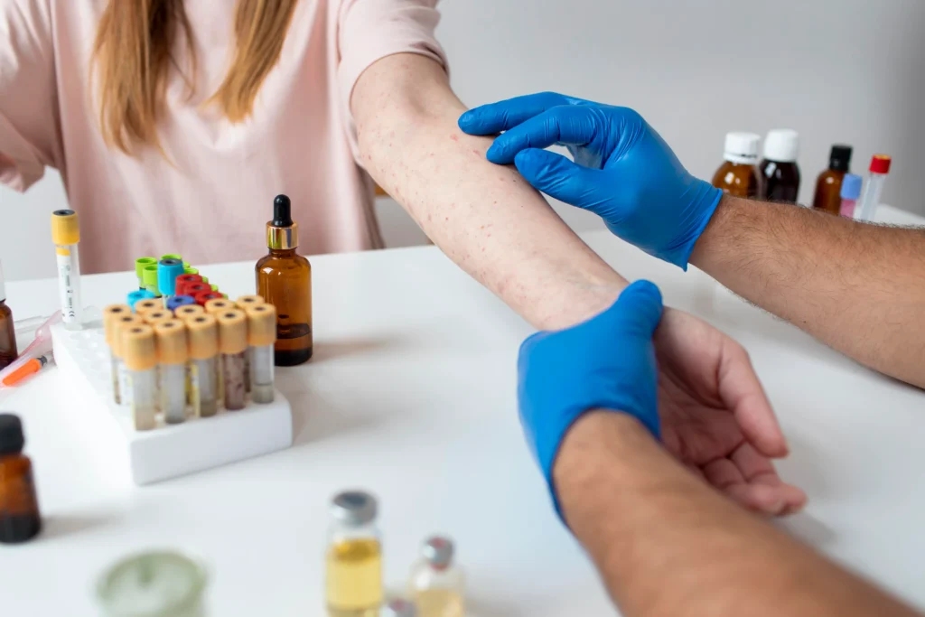 Eczema Symptoms Causes & Treatment Guide