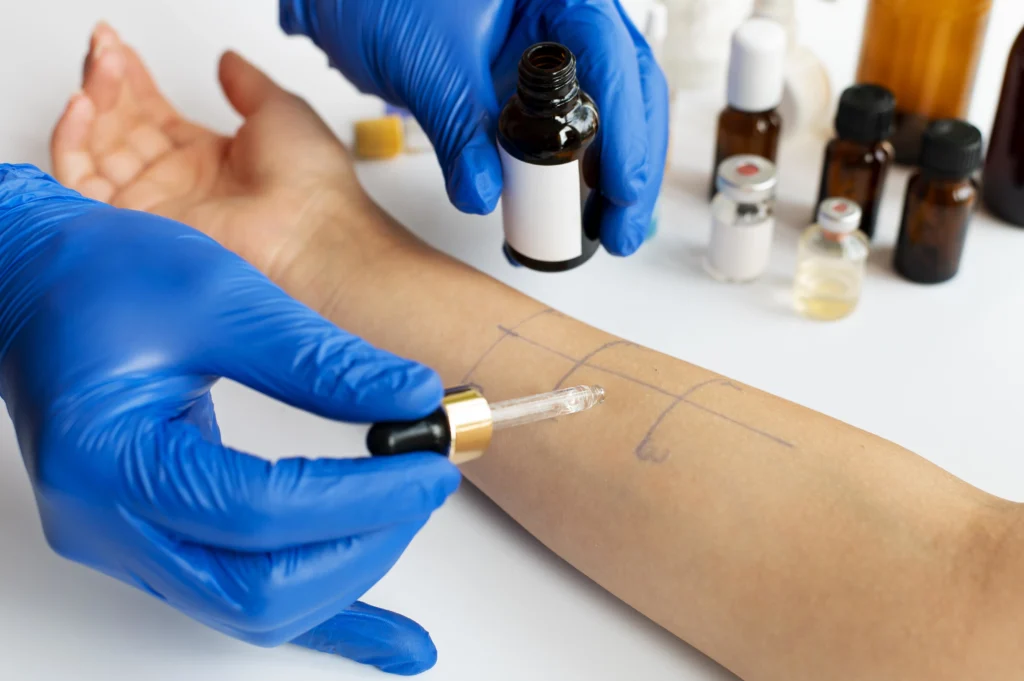 Dermatitis Symptoms Causes & Treatment Guide