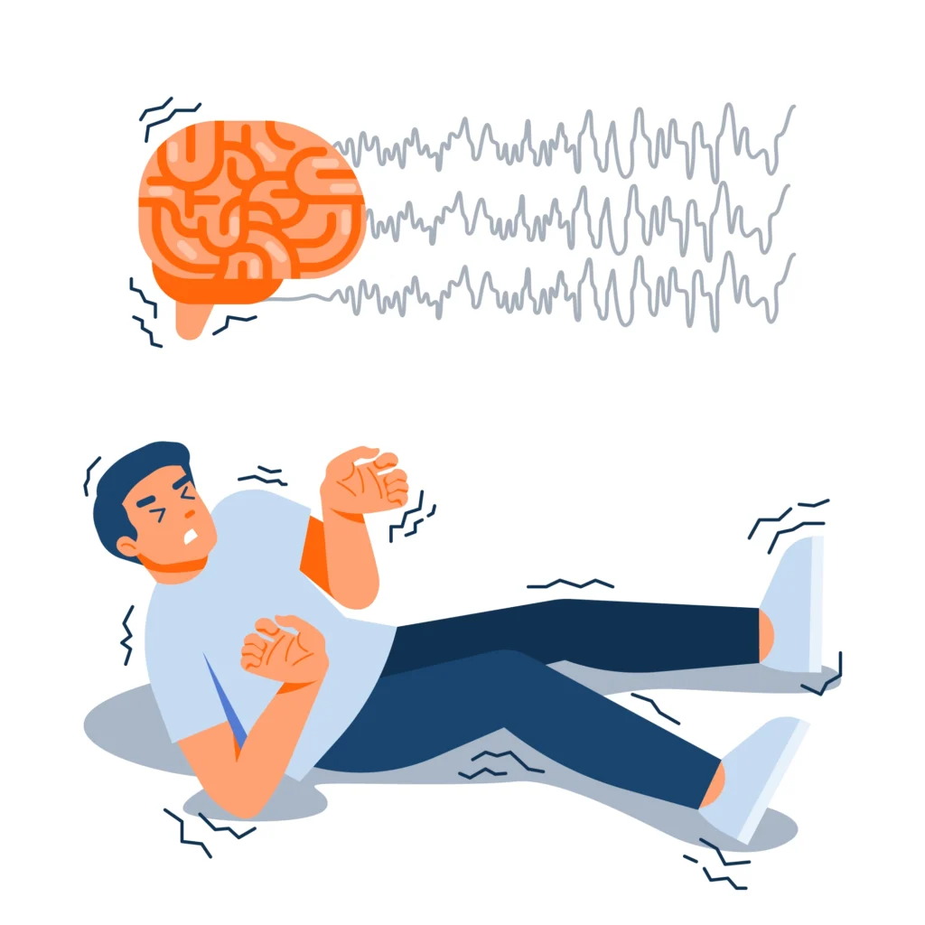 Epilepsy Symptoms Causes & Treatment Guide