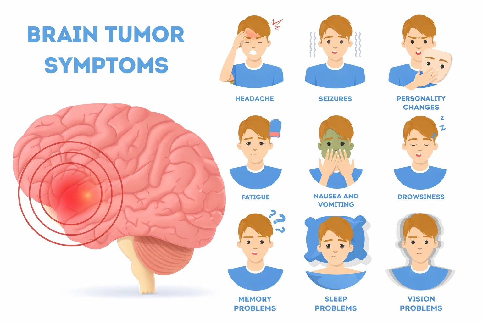 Brain Tumor Symptoms, Causes & Treatment Guide
