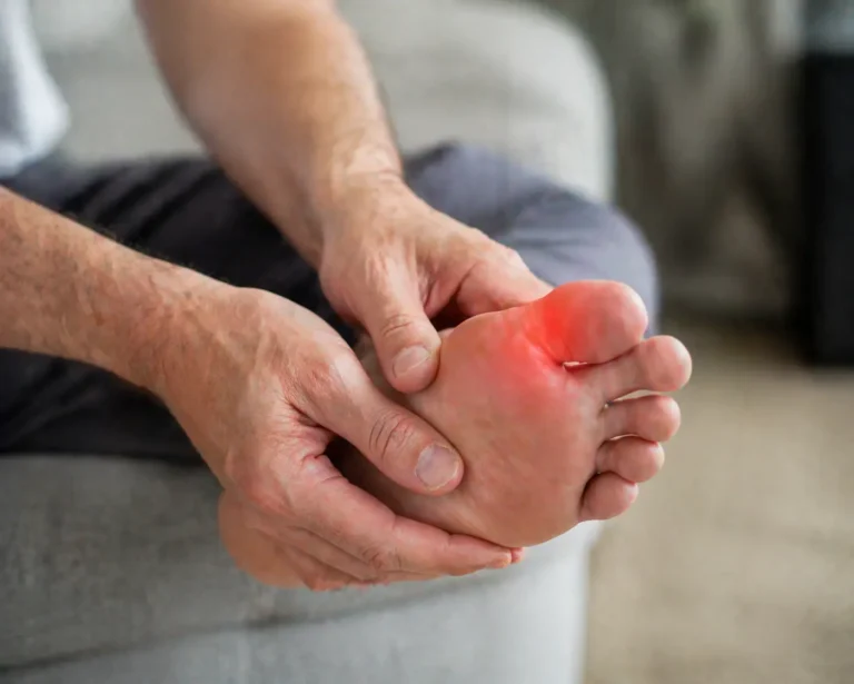 Gout Symptoms, Causes & Treatment Guide