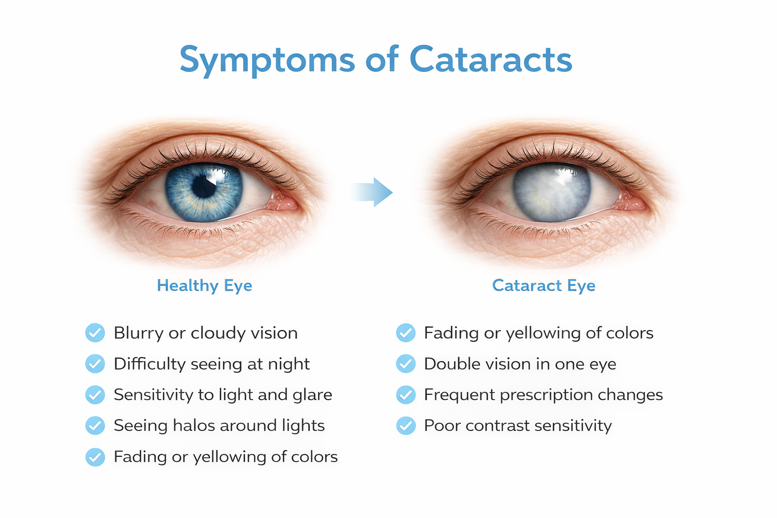 Cataracts Symptoms, Causes & Treatment Guide