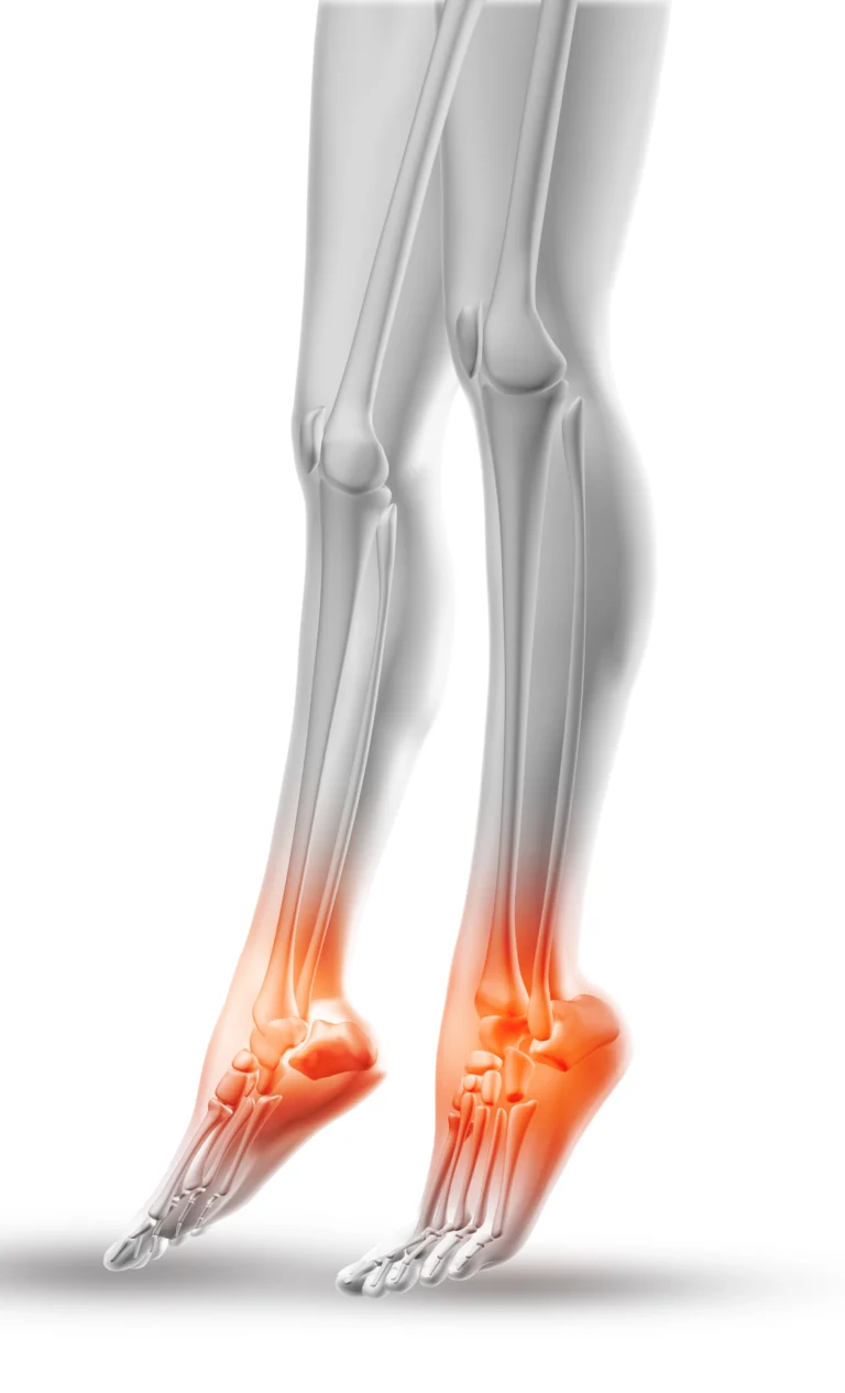 Foot Pain Conditions Symptoms Causes & Treatment Guide