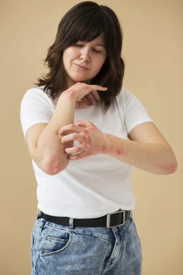 Food Allergy Symptoms Causes and Treatment Guide