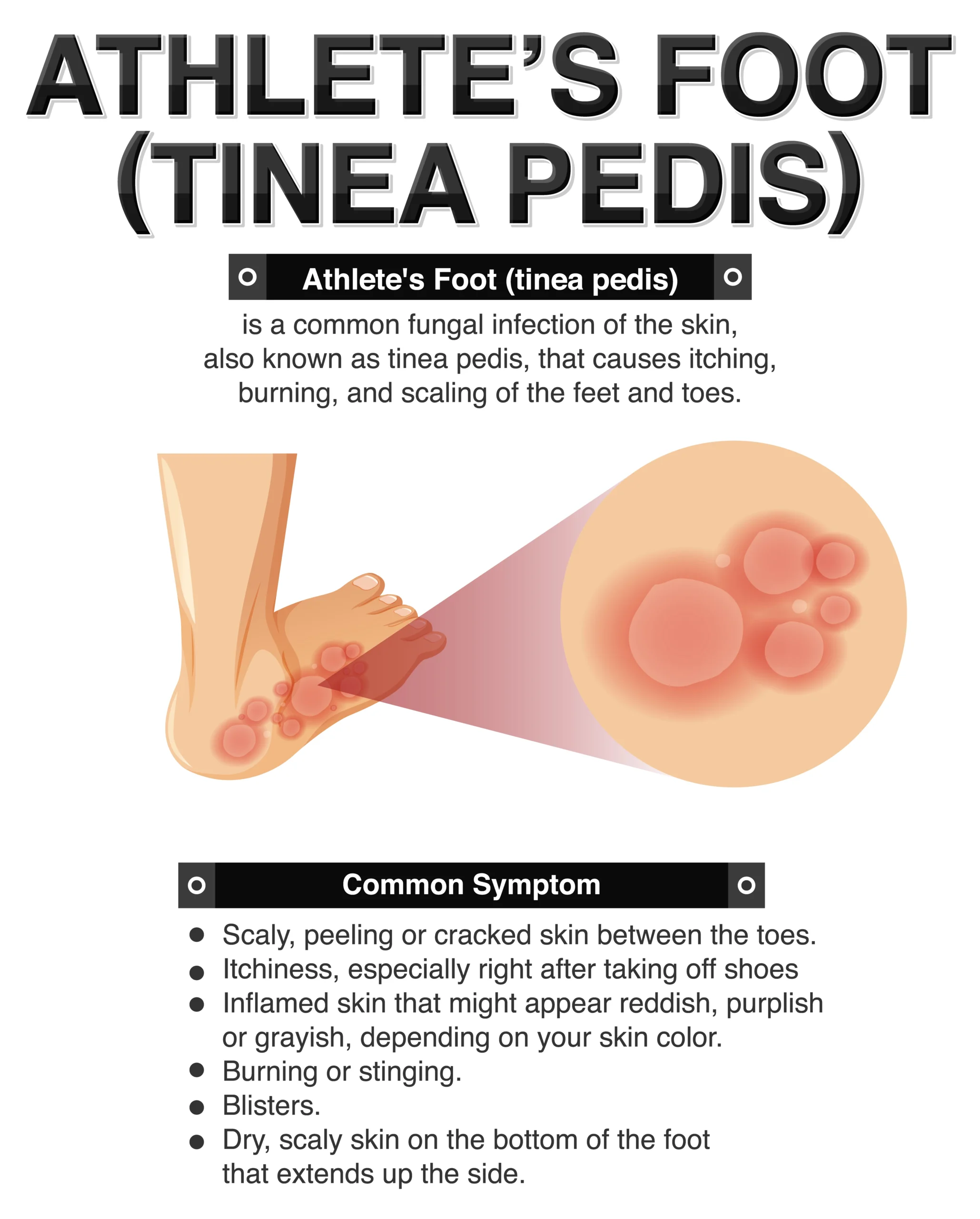 Gout Symptoms, Causes & Treatment Guide