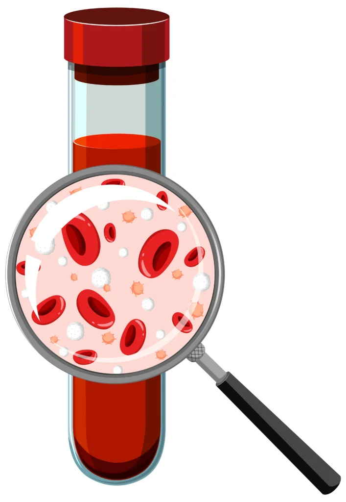 Iron Deficiency Anemia: Symptoms, Causes & Treatment